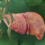 Luttez contre la stéatose hépatique avec cette plante aux puissantes vertus purifiantes et diurétiques !