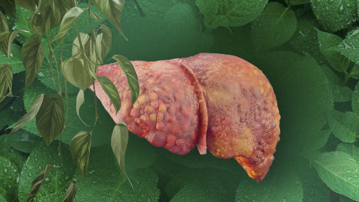 Luttez contre la stéatose hépatique avec cette plante aux puissantes vertus purifiantes et diurétiques !