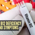 Vous êtes toujours fatigué ? Vérifiez ces signes de carence en vitamine B12 !