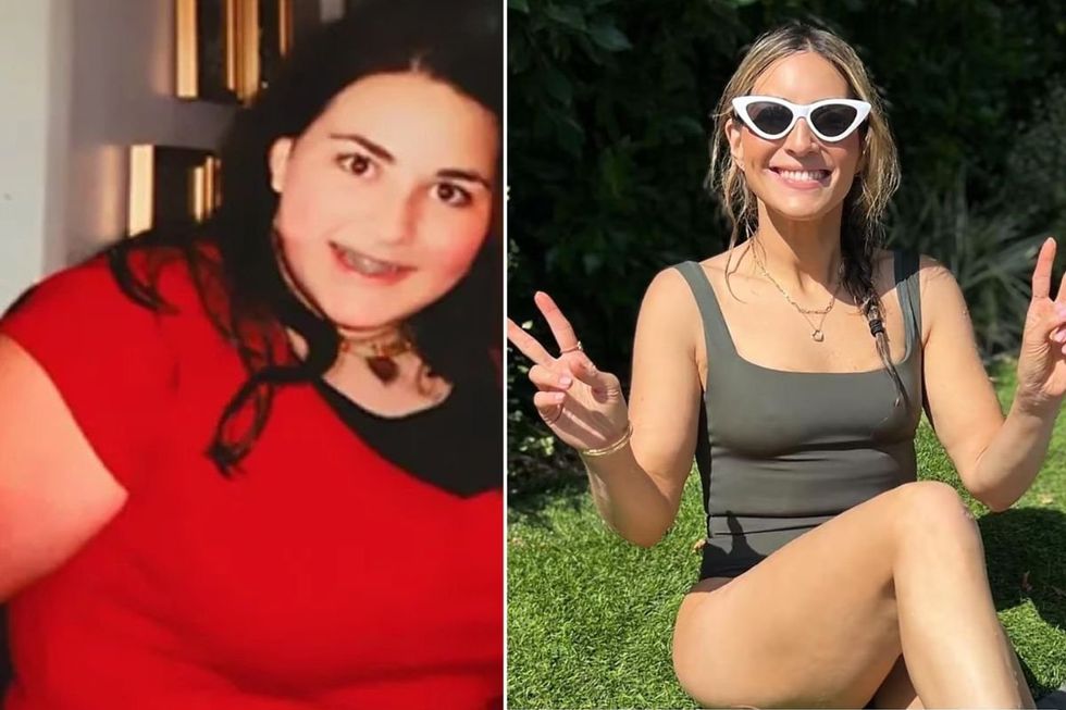 Ilana avant et après