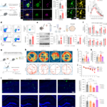 Exercice : améliore la cognition chez les souris Alzheimer grâce à des vésicules extracellulaires qui boostent le nettoyage des plaques par les microglies.