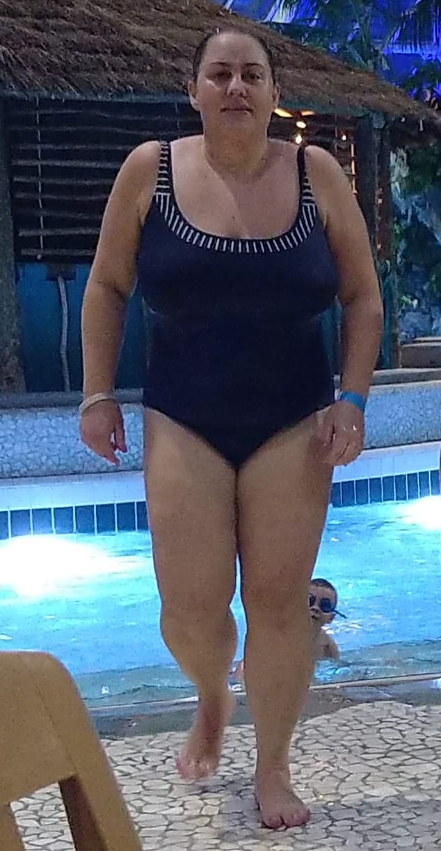 Comment j'ai perdu du poids après avoir arrêté les injections de graisse : incroyable mais vrai, voici le régime et les exercices qui ont sculpté ma silhouette.