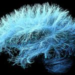 Un complément pour les douleurs articulaires pourrait accélérer la perte de mémoire liée à Alzheimer