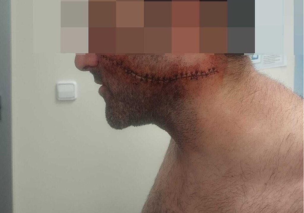 Sœur de la victime à Málaga : « Une cicatrice pour la vie »
