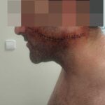Sœur de la victime à Málaga : « Une cicatrice pour la vie »