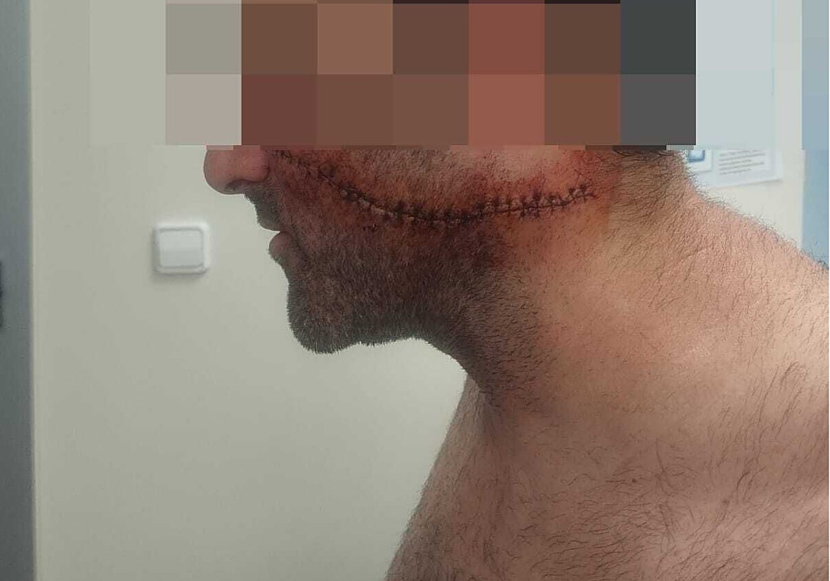 Sœur de la victime à Málaga : « Une cicatrice pour la vie »