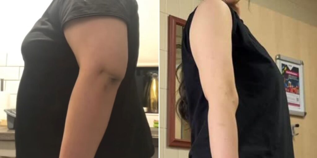 Une transformation impressionnante des bras : elle a perdu 60 kg grâce à une routine de cinq exercices avec haltères !
