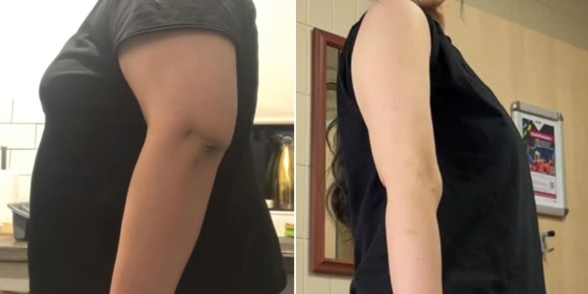 Une transformation impressionnante des bras : elle a perdu 60 kg grâce à une routine de cinq exercices avec haltères !
