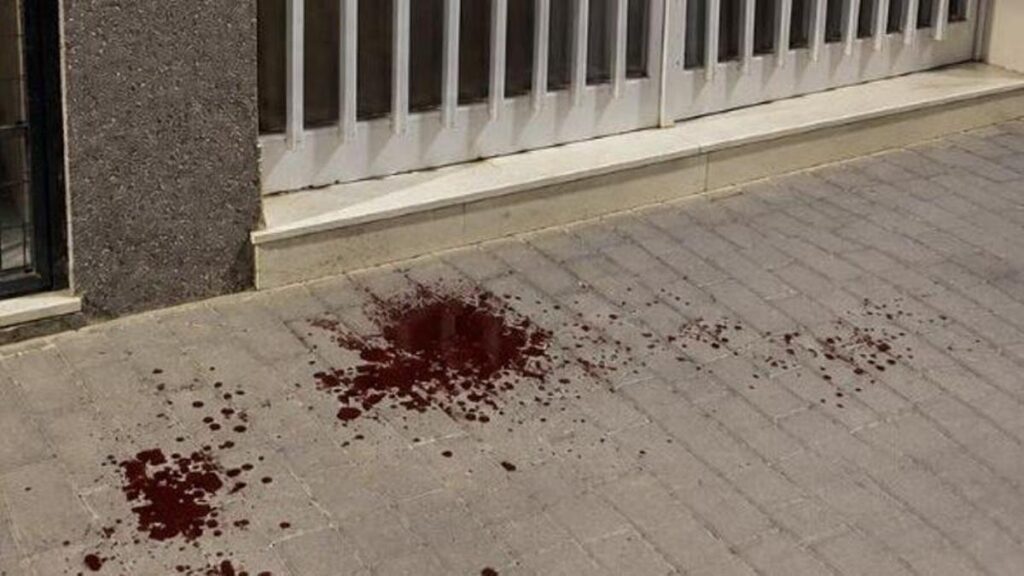 Deux nouveaux suspects arrêtés pour l'agression d'un octogénaire à Lorca : "Ils m'ont frappé à la tête, je dois me faire opérer de l'œil"