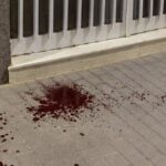 Deux nouveaux suspects arrêtés pour l'agression d'un octogénaire à Lorca : "Ils m'ont frappé à la tête, je dois me faire opérer de l'œil"