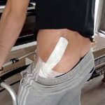 Un coup de machette inattendu : comment une mauvaise position aurait tout changé